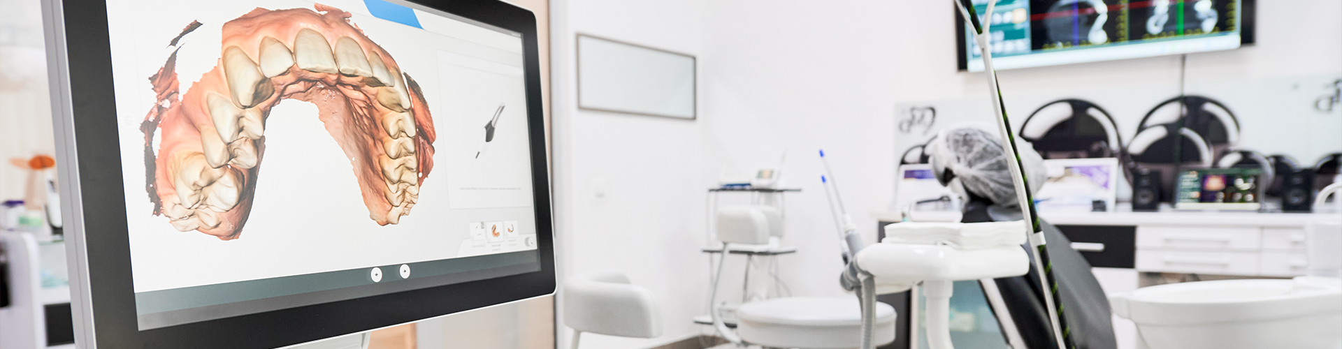 dentist office with image of upper teeth on screen